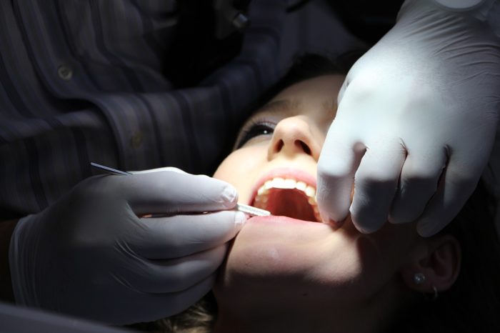 Warum leiden unsere Zähne an Karies? Karies natürlich heilen.